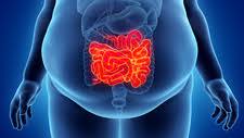 Obesity & Lipid Metabolism