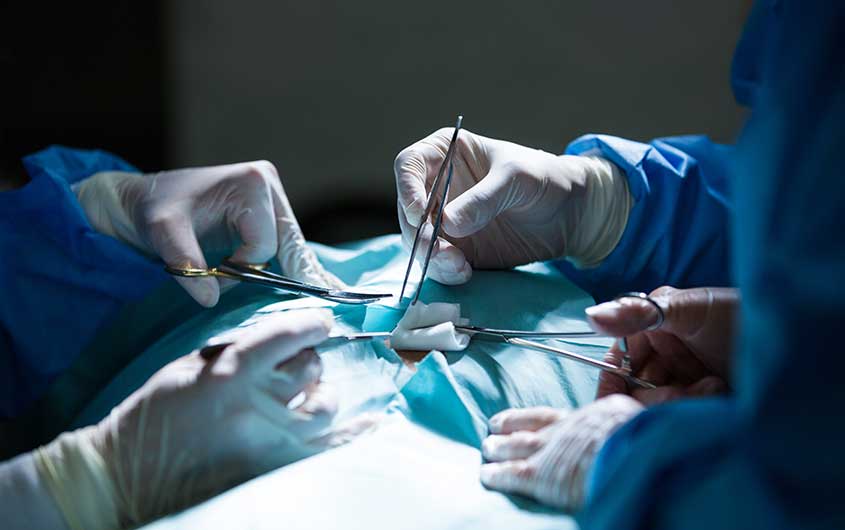 HPB Surgery
